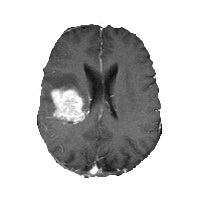 A picture containing echinoderm, invertebrate, gear

Description automatically generated